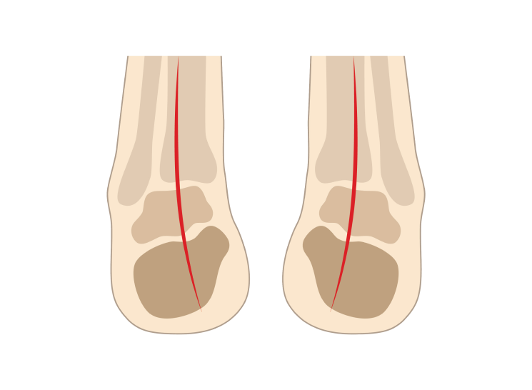 Supination