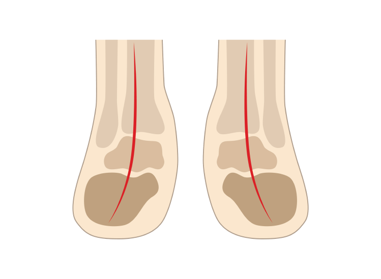 Pronation